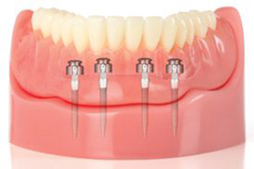 Dental clinic Vasant Vihar
