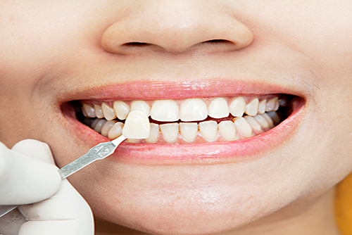 Dental clinic Vasant Vihar